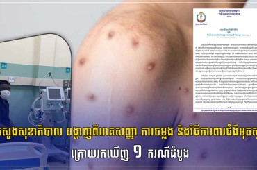 ក្រសួងសុខាភិបាល បង្ហាញពីរោគសញ្ញា ការចម្លង និងវិធីការពារជំងឺអុតស្វា ក្រោយរកឃើញ ១ ករណីដំបូង